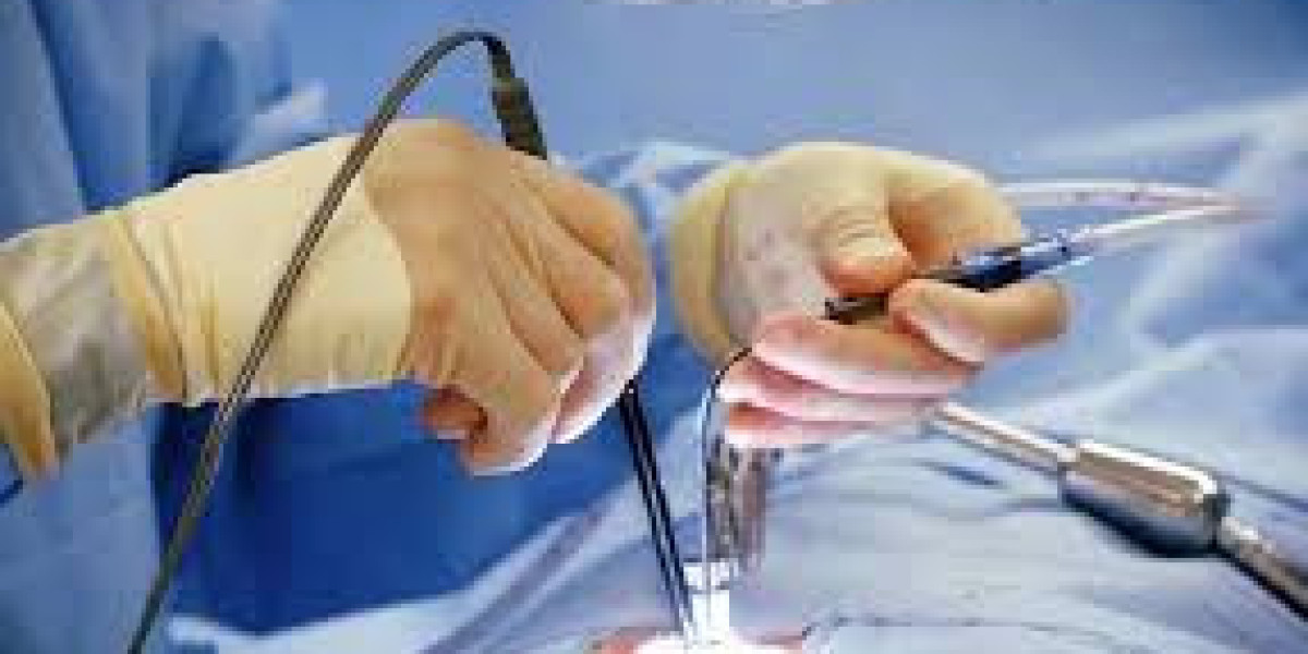 Key Insights from Endoscopic Spinal Surgery Market Research