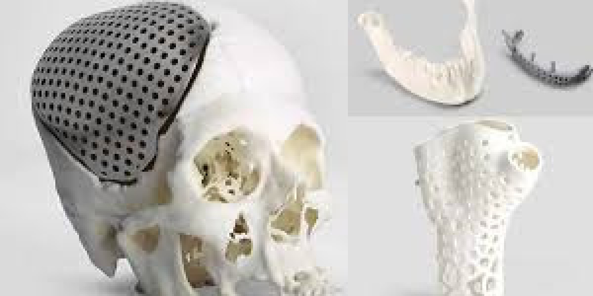 In-Depth 3D Printed Bones Market Research Provides Strategic Insights for Stakeholders