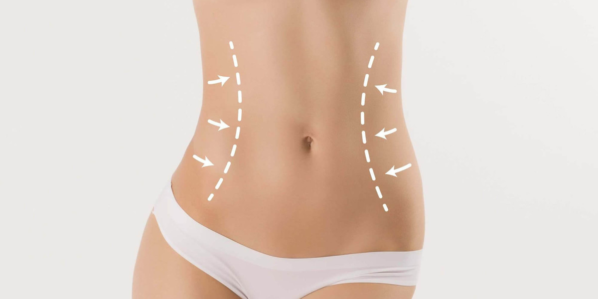 What is Body Contouring in Islamabad?