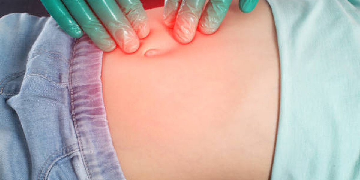 What Should You Ask About Hernia Surgery Pricing?