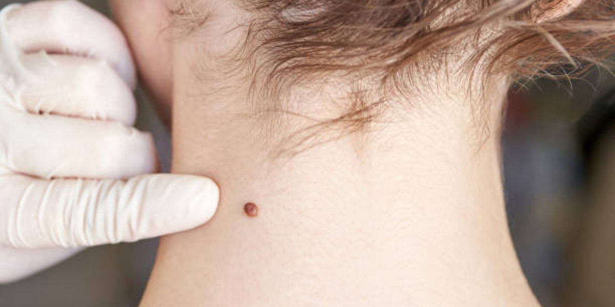 Article Picture