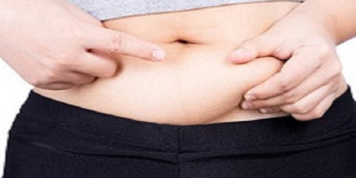 The Role of Liposuction in Achieving a Slimmer Silhouette