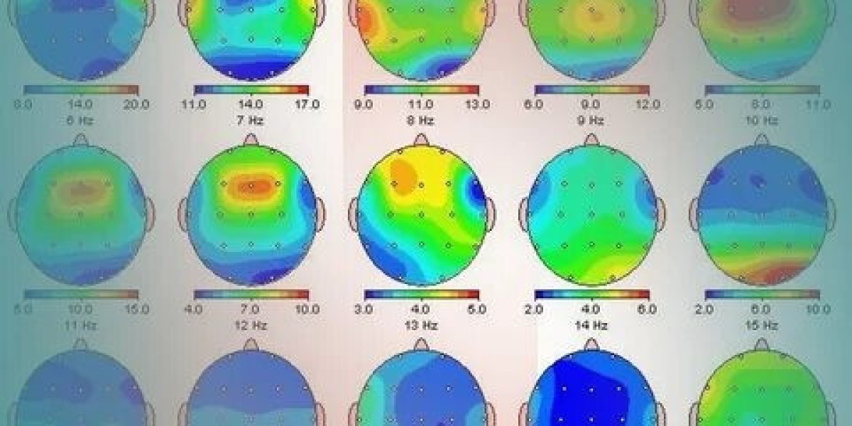 qEEG Assessment: Understanding Brain Mapping for Mental Wellness and Cognitive Health